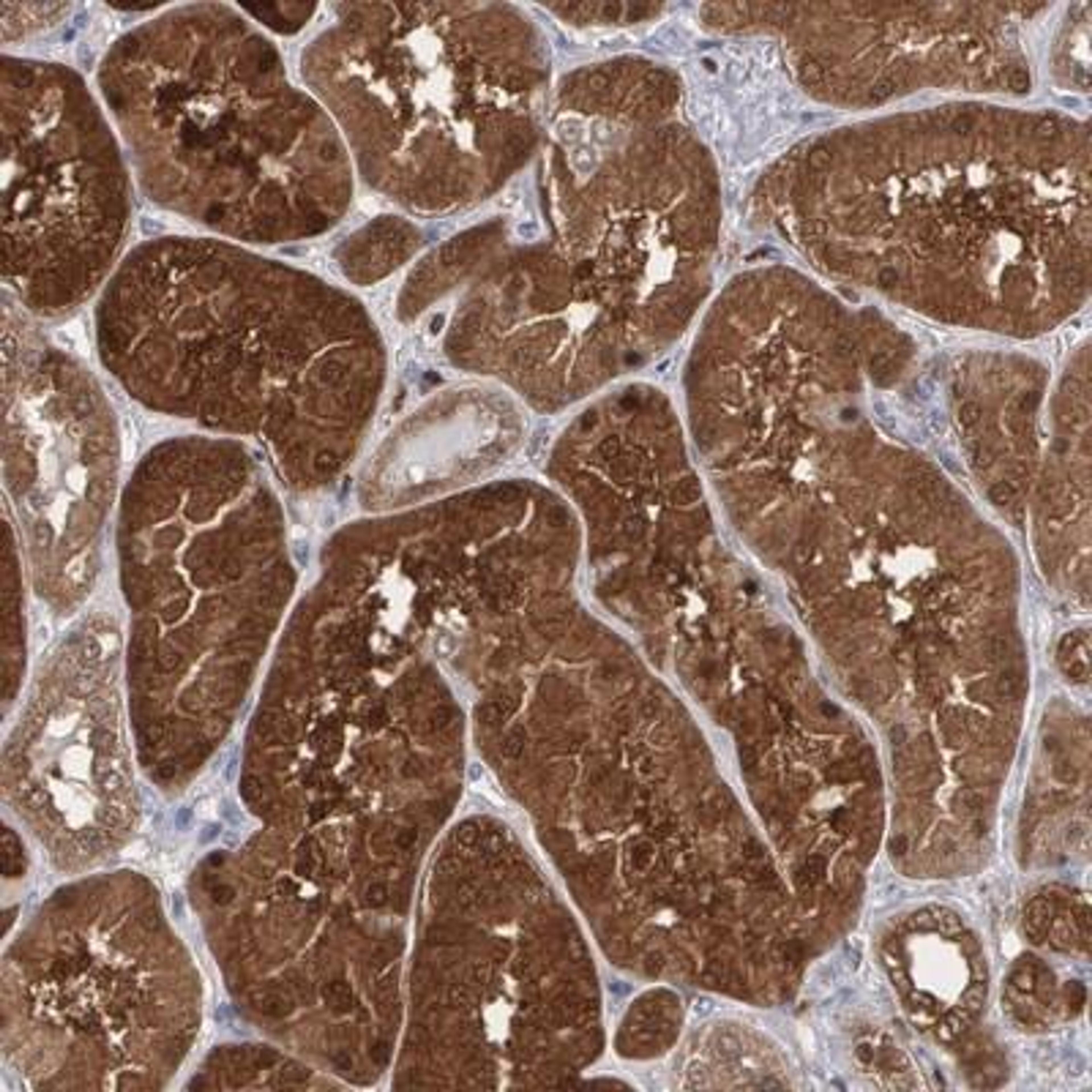 Immunohistochemistry-Paraffin: Purine Nucleoside Phosphorylase/PNP Antibody [NBP1-82541] - Staining of human kidney shows strong cytoplasmic and nuclear positivity in cells of tubules.