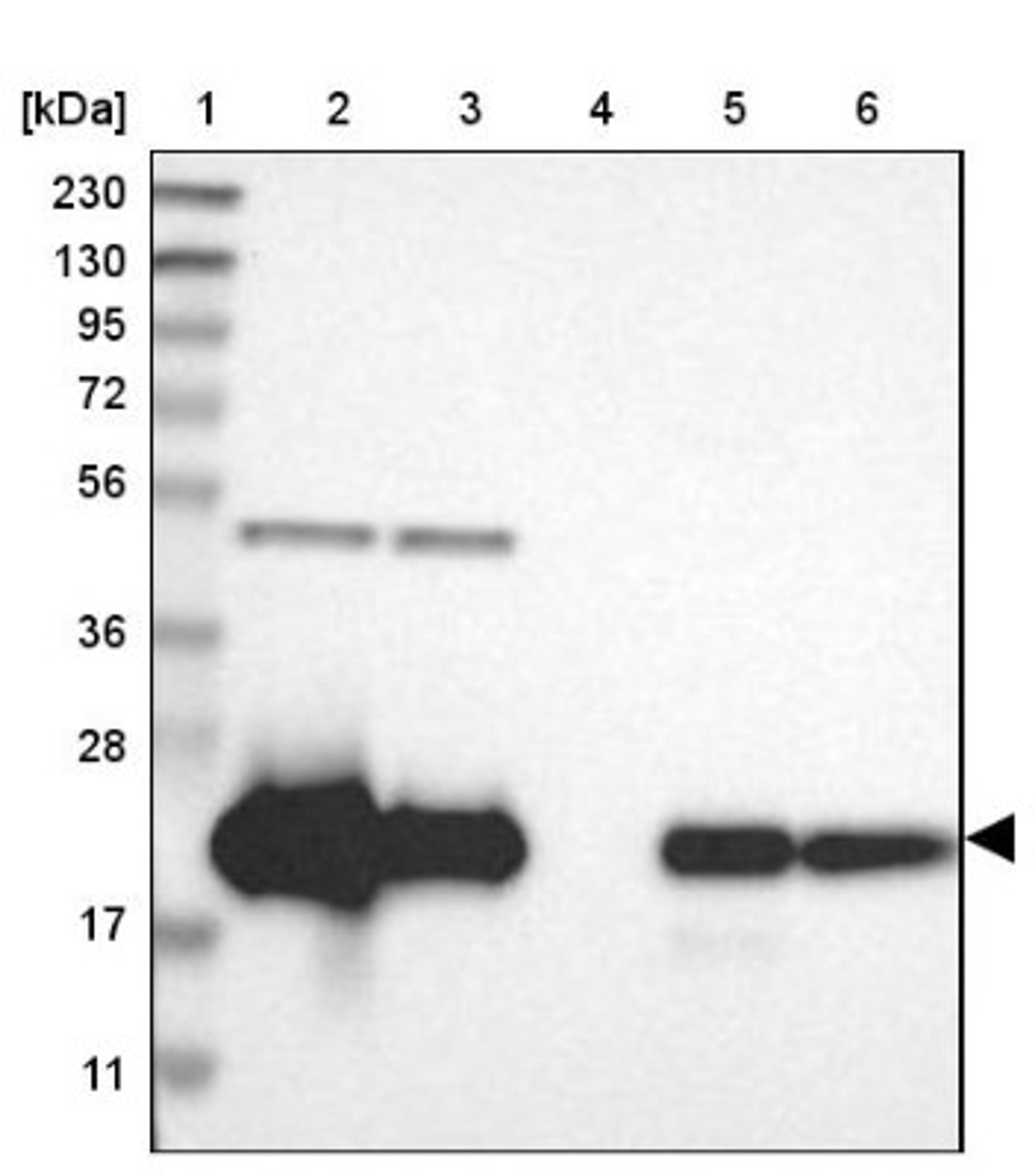 Western Blot: Cytochrome b5 Outer Mitochondrial Membrane Antibody [NBP1-88039] - Lane 1: Marker [kDa] 230, 130, 95, 72, 56, 36, 28, 17, 11<br/>Lane 2: Human cell line RT-4<br/>Lane 3: Human cell line U-251MG sp<br/>Lane 4: Human plasma (IgG/HSA depleted)<br/>Lane 5: Human liver tissue<br/>Lane 6: Human tonsil tissue