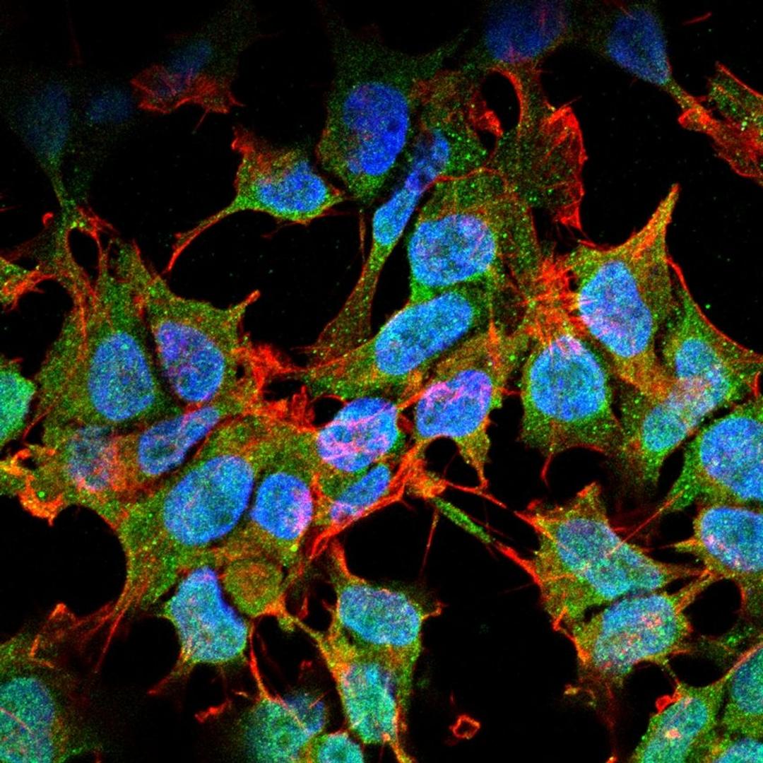 Immunofluorescence analysis of neuroblastoma cell line sk-n-be using Kir6.1 antibody