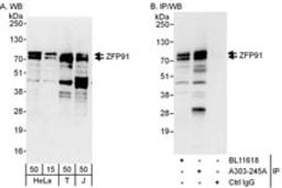 Detection of human ZFP91 by western blot and immunoprecipitation.