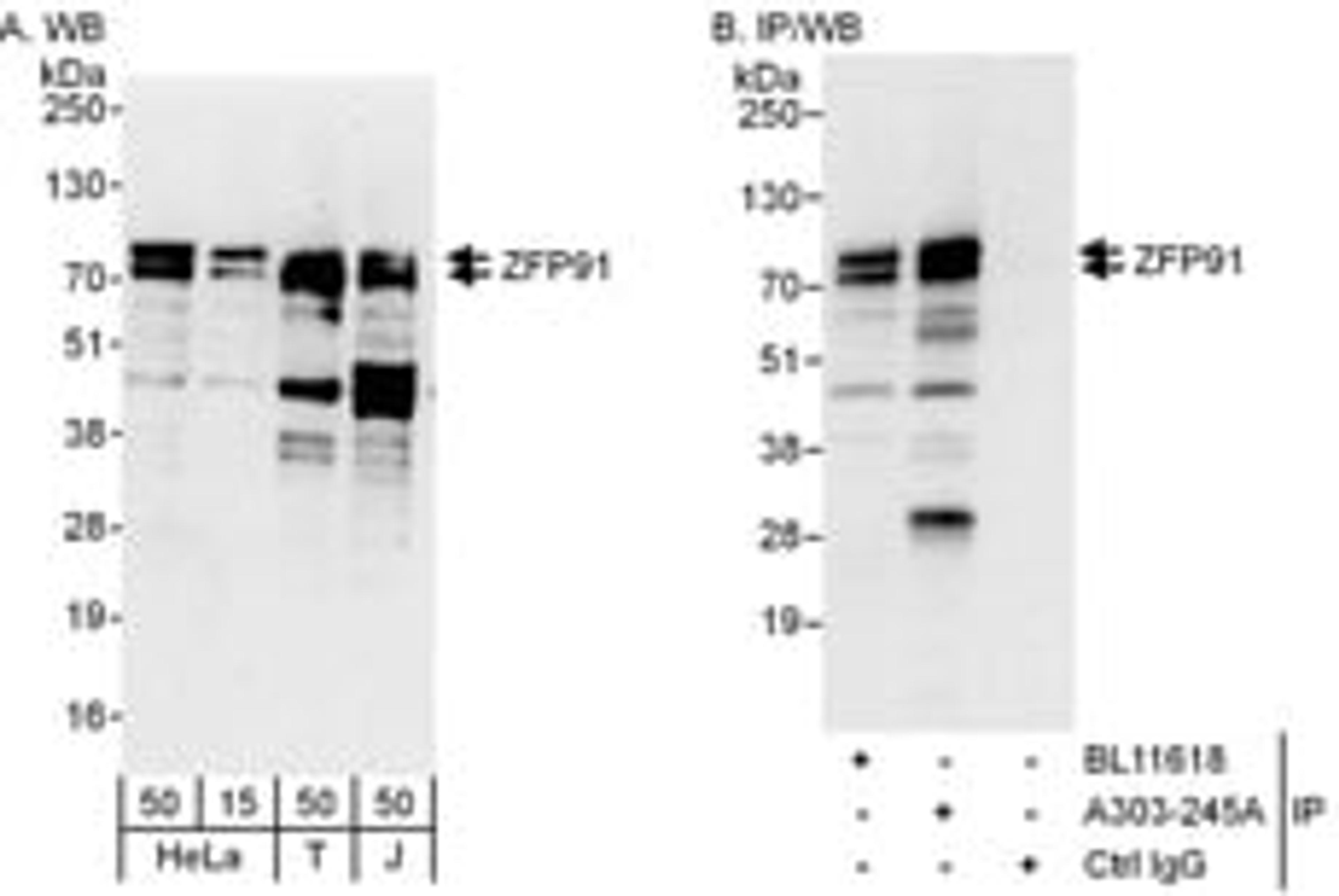 Detection of human ZFP91 by western blot and immunoprecipitation.