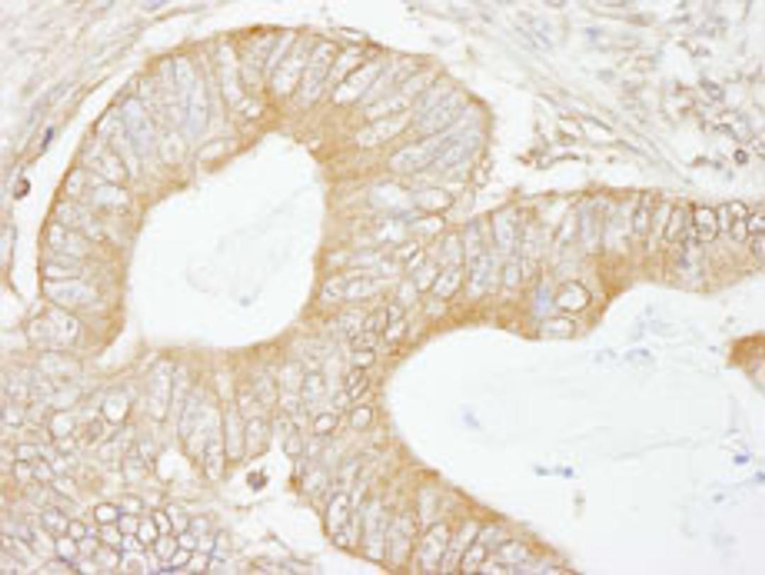 Detection of human USP5/IsoT by immunohistochemistry.