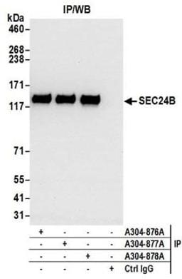 Detection of human SEC24B by western blot of immunoprecipitates.