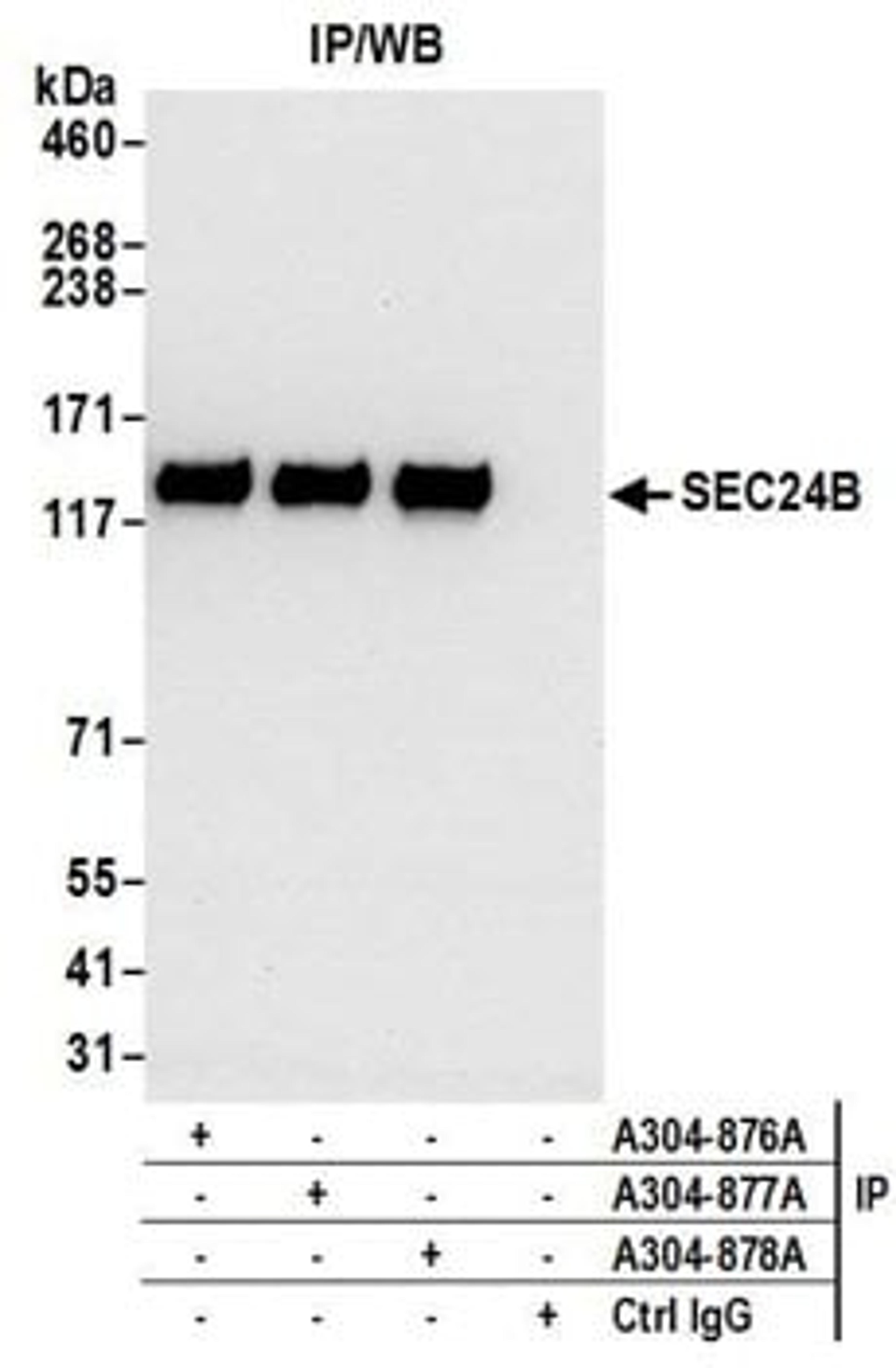 Detection of human SEC24B by western blot of immunoprecipitates.