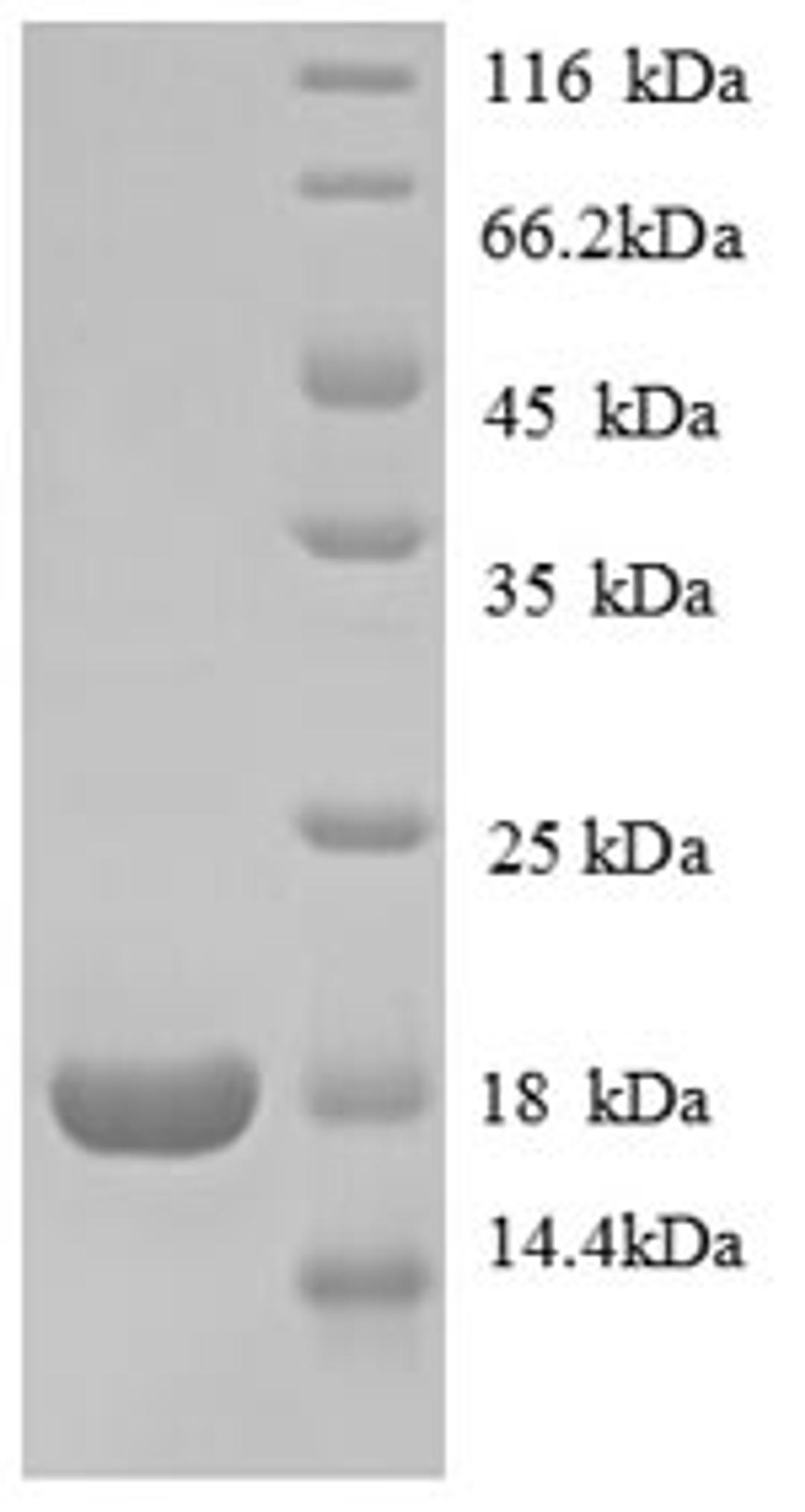 (Tris-Glycine gel) Discontinuous SDS-PAGE (reduced) with 5% enrichment gel and 15% separation gel.