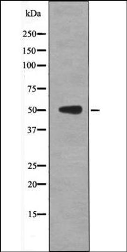 Western blot analysis of EGF treated NIH-3T3 whole cell lysates using p53 -Phospho-Thr55- antibody