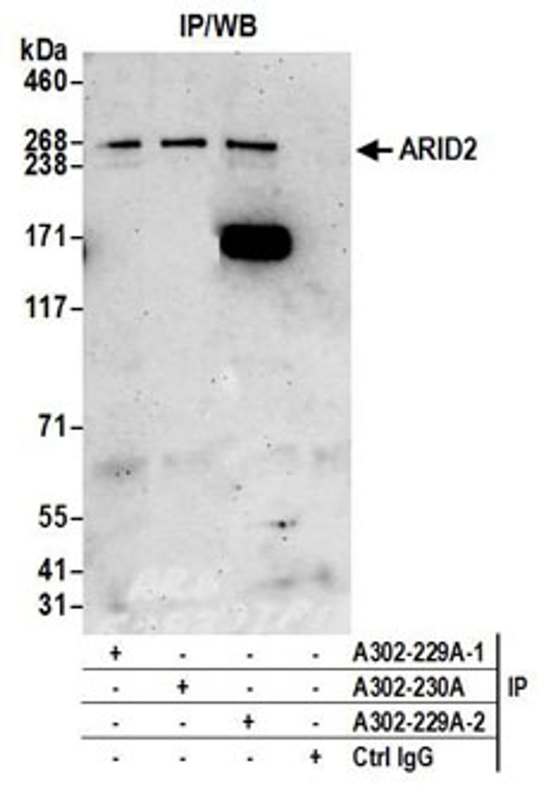 Detection of human ARID2 by western blot of immunoprecipitates.