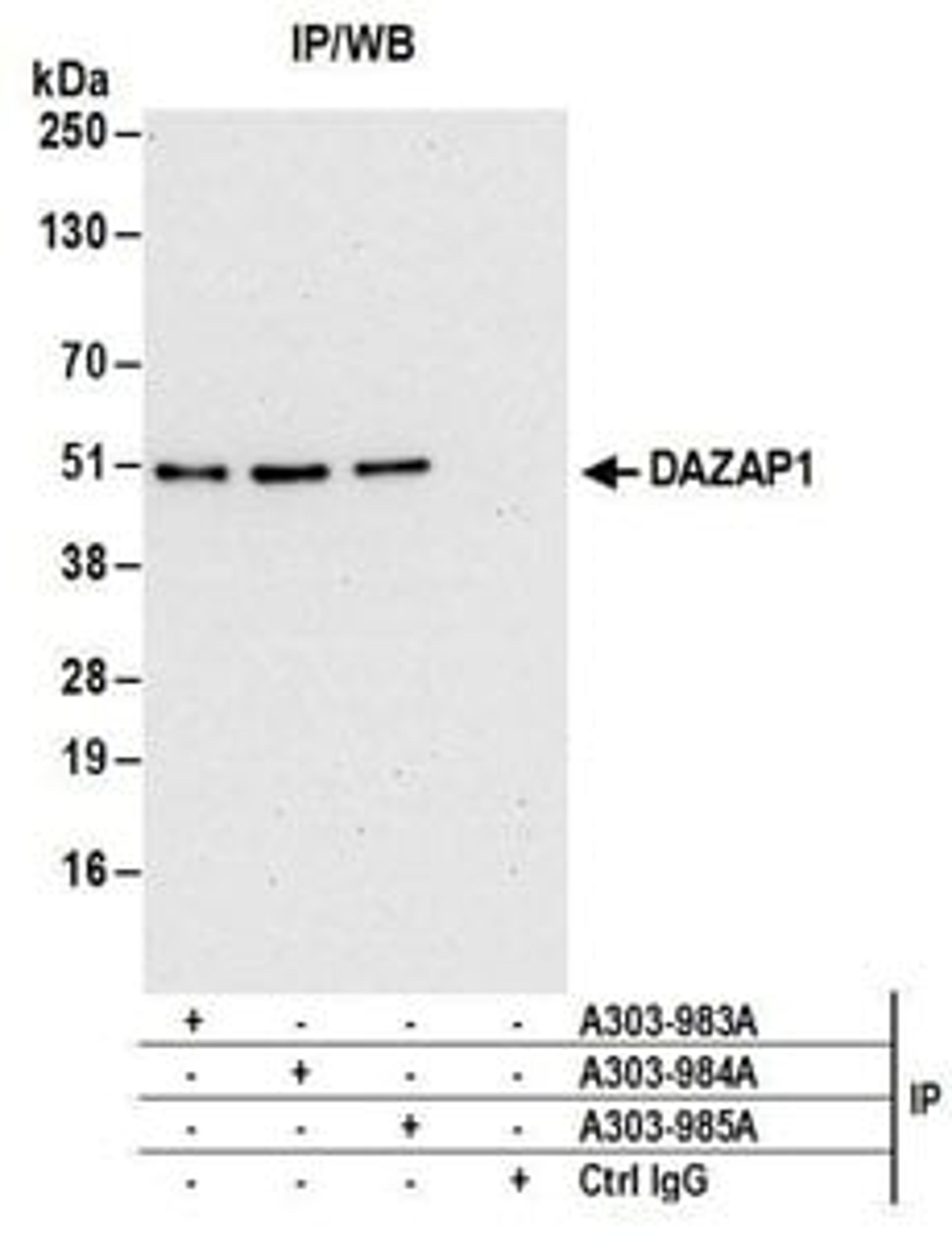 Detection of human DAZAP1 by western blot of immunoprecipitates.