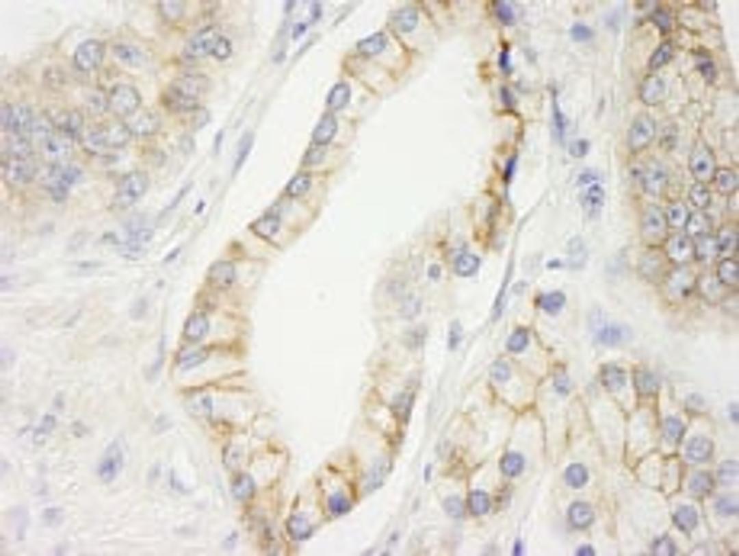 Detection of human KIAA0528 by immunohistochemistry.