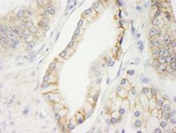 Detection of human KIAA0528 by immunohistochemistry.