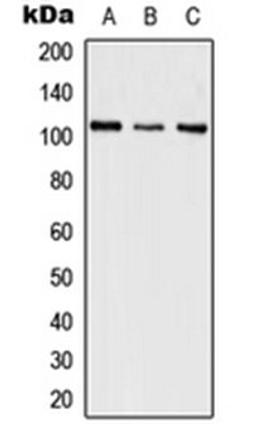 Western blot analysis of HeLa (Lane 1), SP2/0 (Lane 2), PC12 (Lane 3) whole cell lysates using SFSWAP antibody