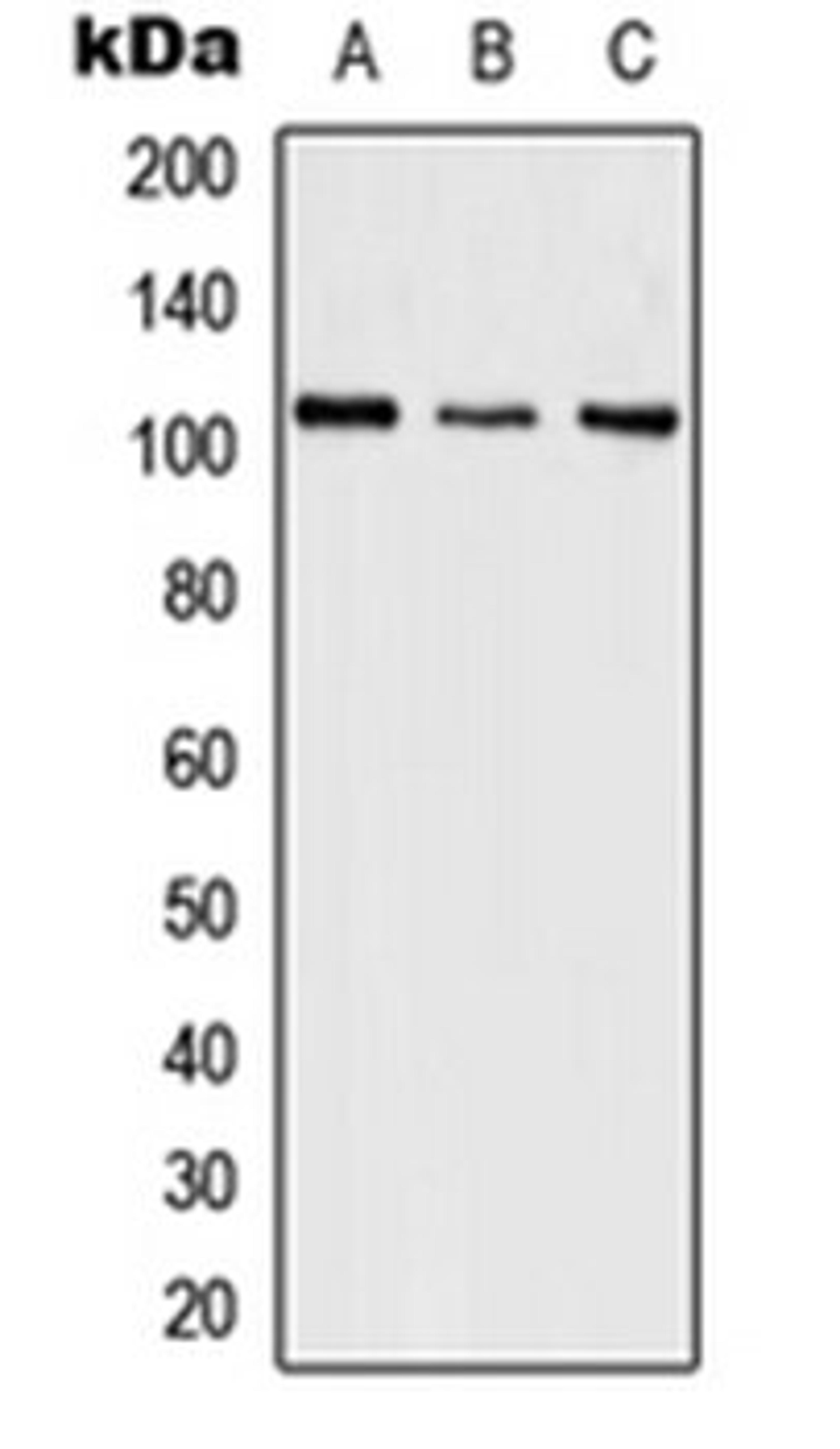 Western blot analysis of HeLa (Lane 1), SP2/0 (Lane 2), PC12 (Lane 3) whole cell lysates using SFSWAP antibody