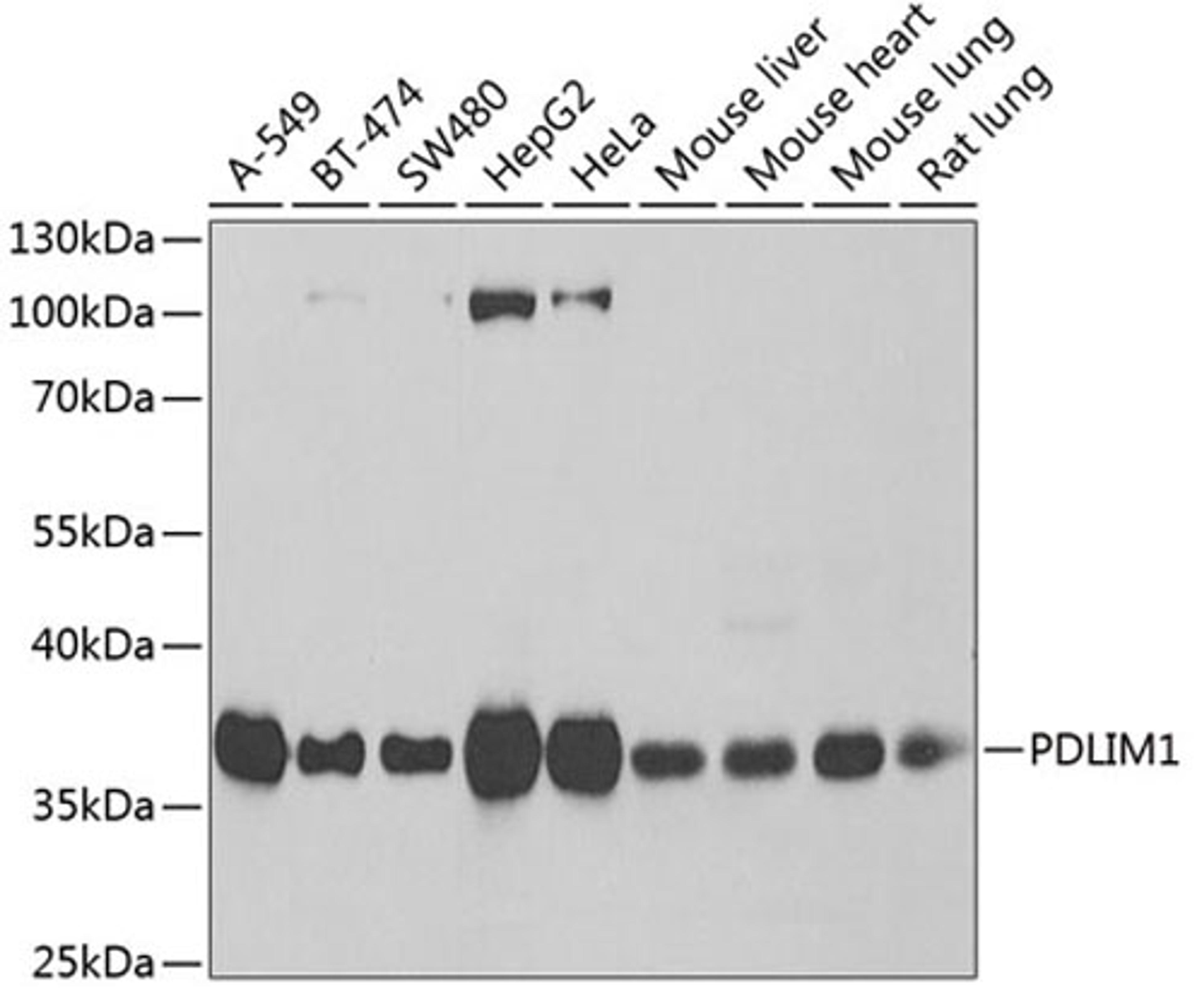 Western blot - PDLIM1 antibody (A6686)