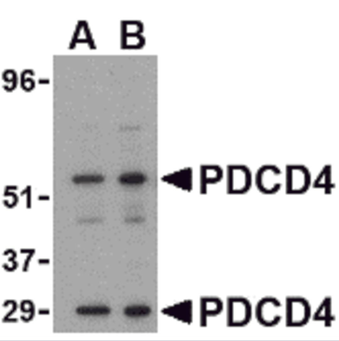 Western blot analysis of PDCD4 in A-20 cell lysate with PDCD4 antibody at (A) 0.5 and (B) 1&#956;g/mL. 