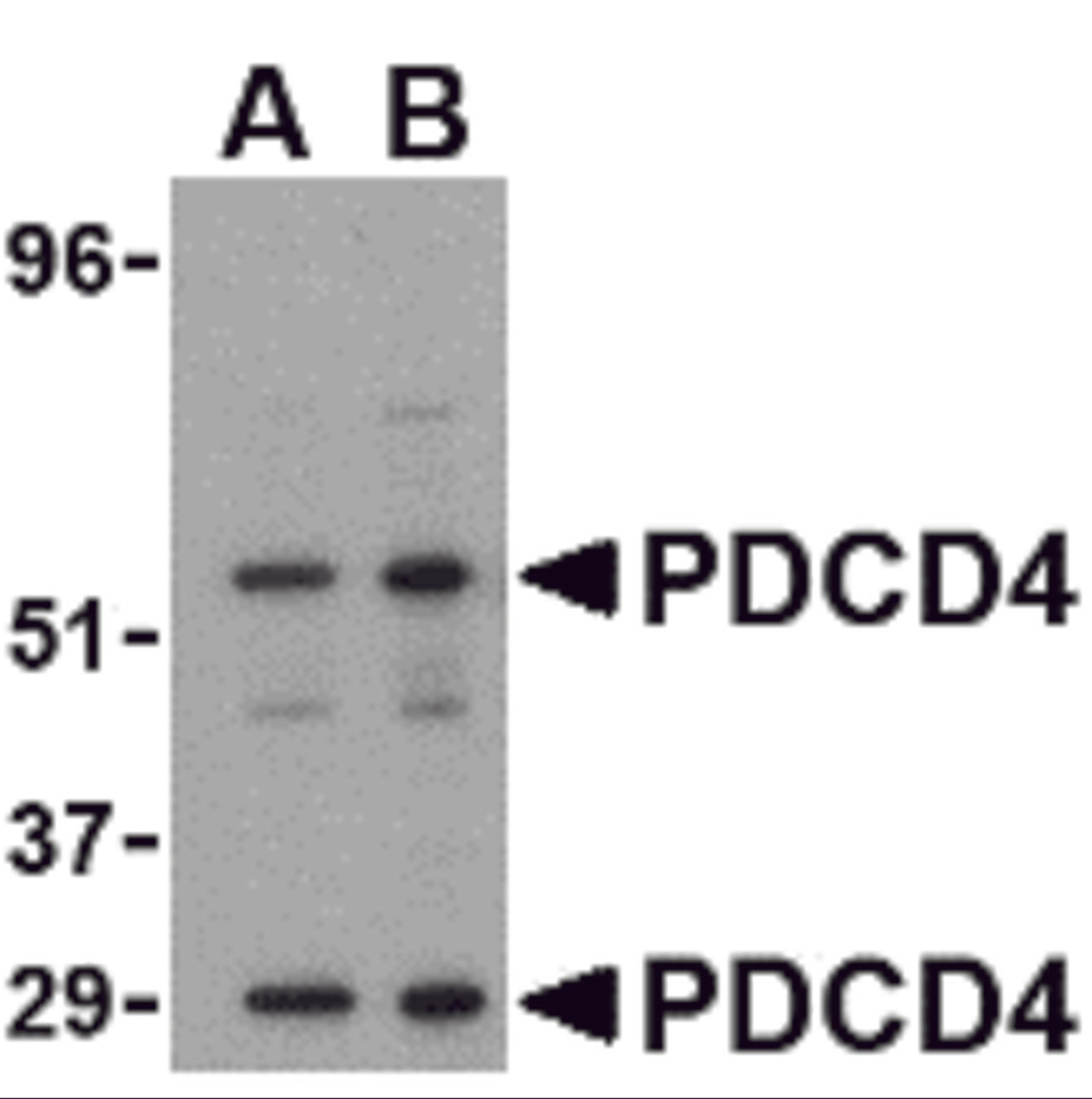 Western blot analysis of PDCD4 in A-20 cell lysate with PDCD4 antibody at (A) 0.5 and (B) 1&#956;g/mL. 