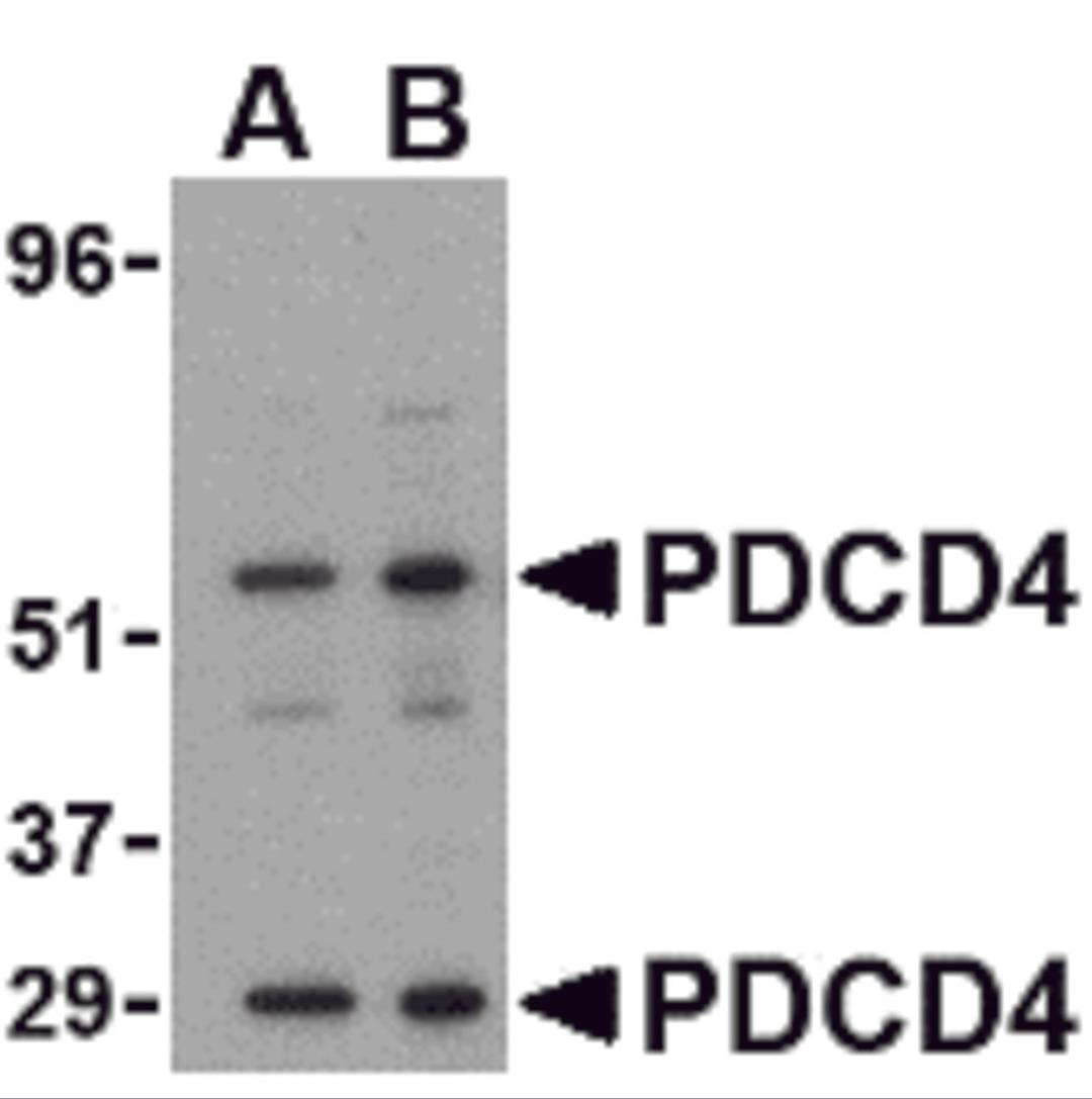 Western blot analysis of PDCD4 in A-20 cell lysate with PDCD4 antibody at (A) 0.5 and (B) 1μg/mL.