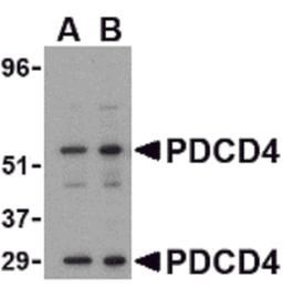 Western blot analysis of PDCD4 in A-20 cell lysate with PDCD4 antibody at (A) 0.5 and (B) 1μg/mL.