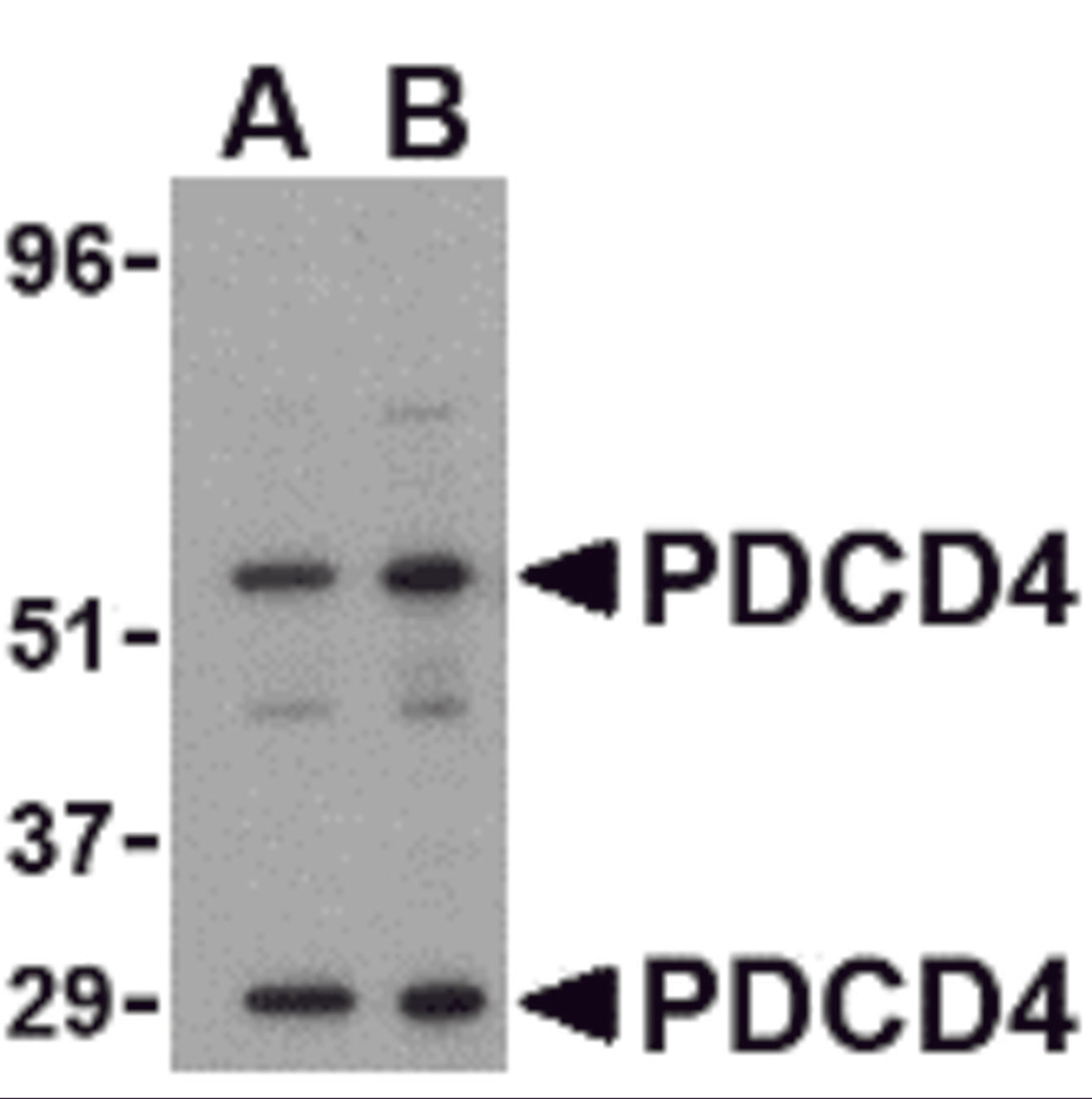 Western blot analysis of PDCD4 in A-20 cell lysate with PDCD4 antibody at (A) 0.5 and (B) 1μg/mL.