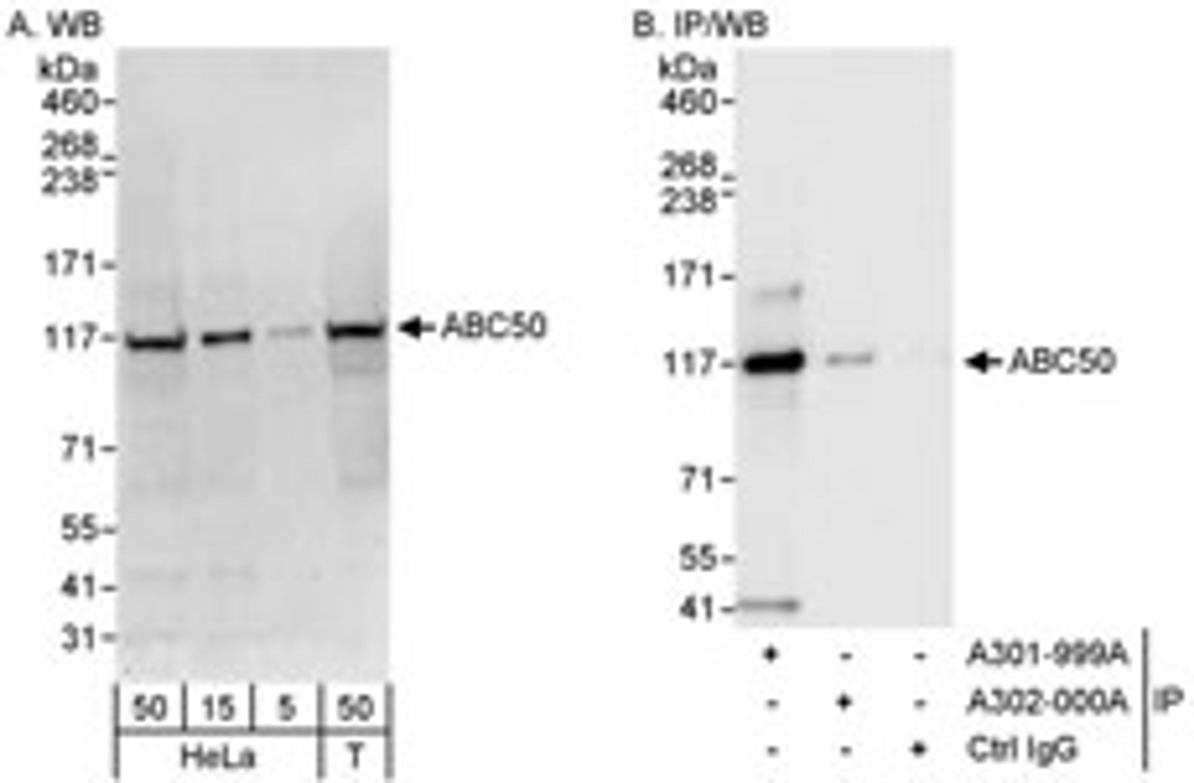 Detection of human ABC50 by western blot and immunoprecipitation.