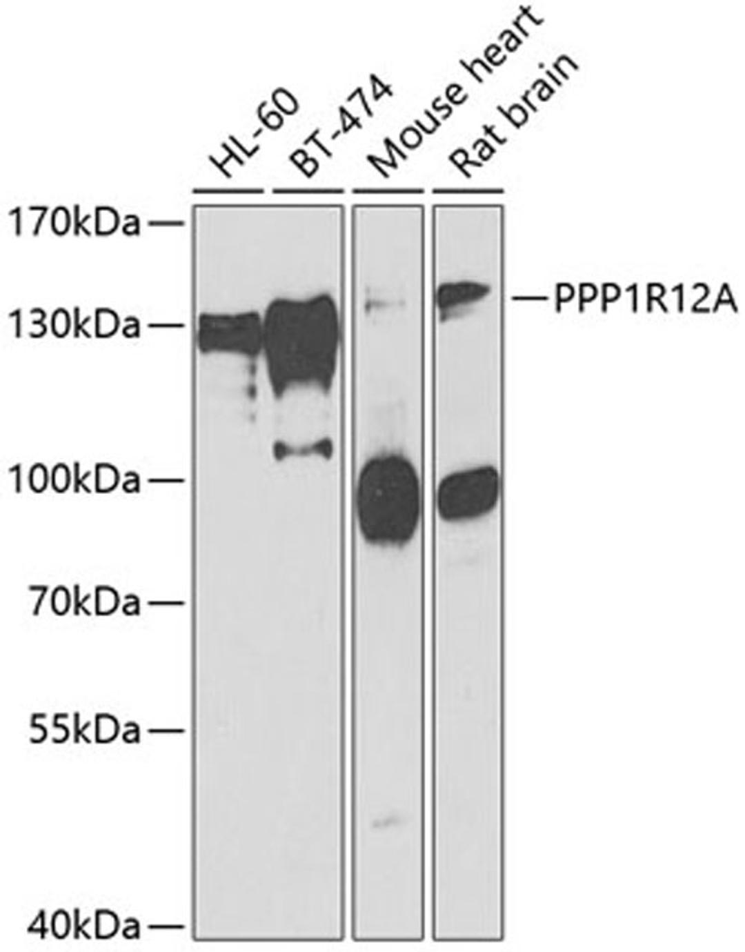 Western blot - PPP1R12A antibody (A6700)