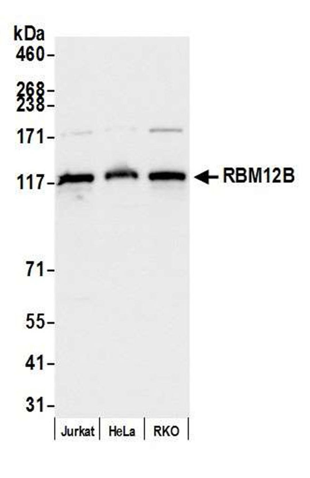 Detection of human RBM12B by WB.