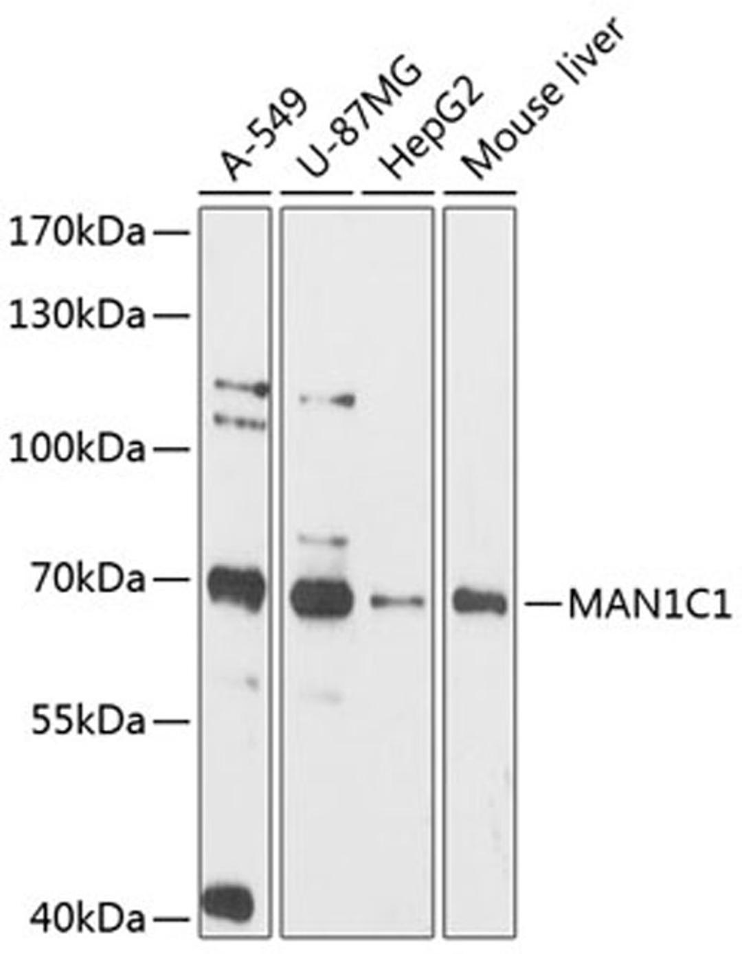 Western blot - MAN1C1 antibody (A12837)