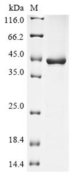 (Tris-Glycine gel) Discontinuous SDS-PAGE (reduced) with 5% enrichment gel and 15% separation gel.