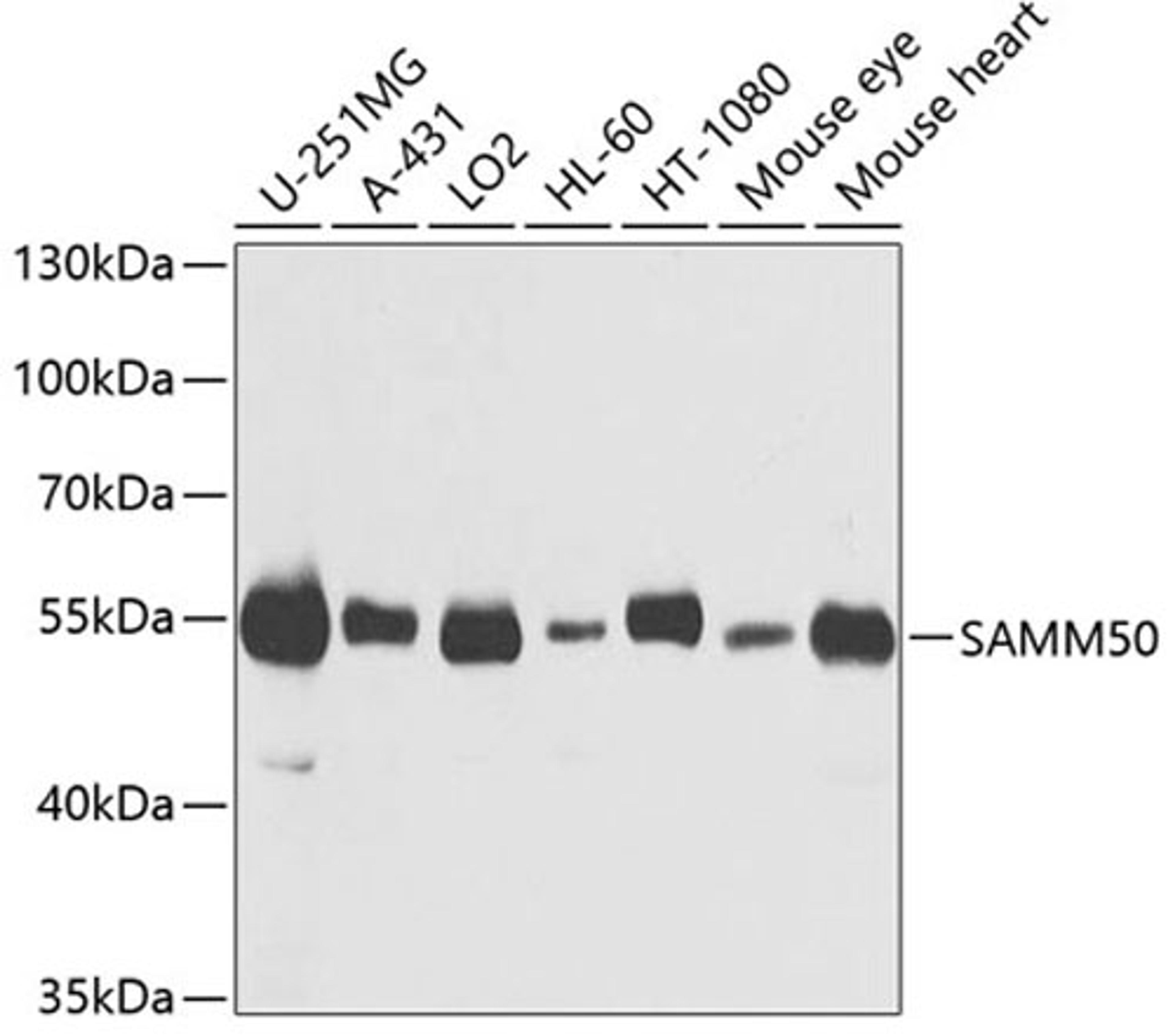 Western blot - SAMM50 antibody (A3401)