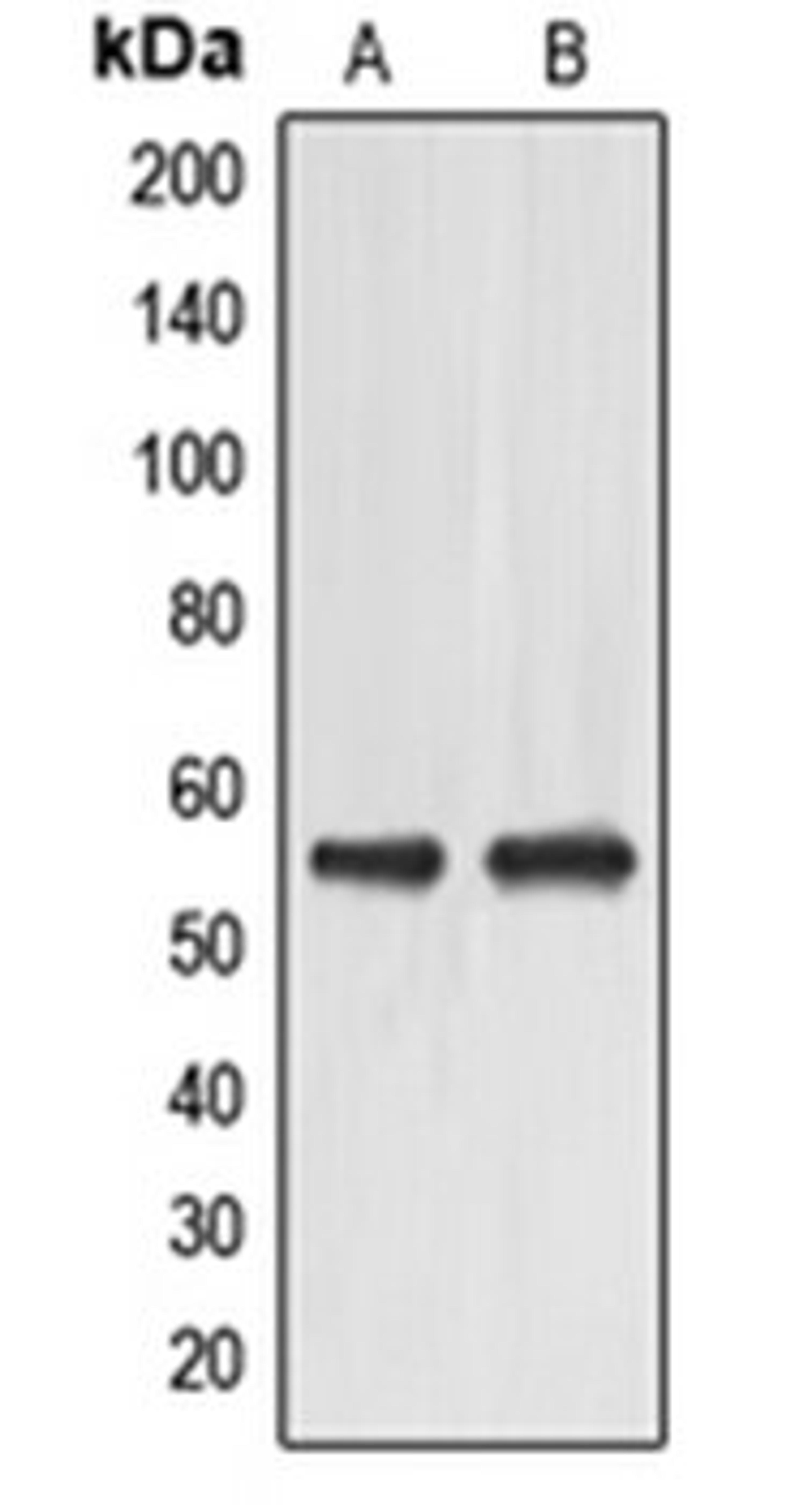 Western blot analysis of HeLa (Lane 1), HuvEc (Lane 2) whole cell lysates using EMR4P antibody