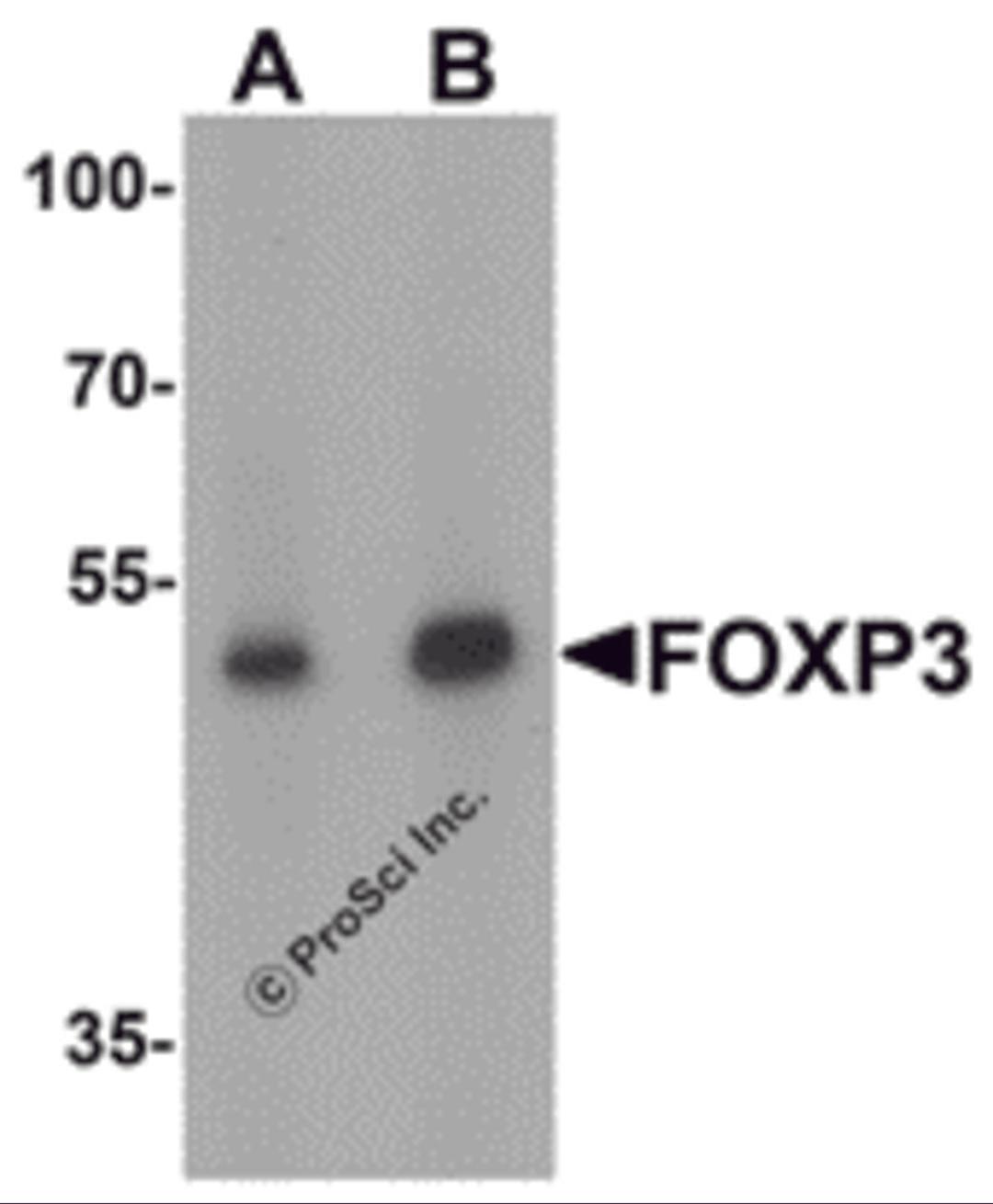 Western blot analysis of FOXP3 in A549 cell lysate with FOXP3 antibody at (A) 1 and (B) 2 &#956;g/mL.