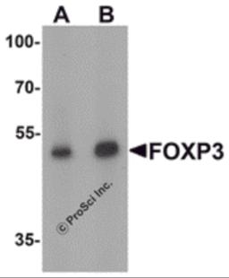 Western blot analysis of FOXP3 in A549 cell lysate with FOXP3 antibody at (A) 1 and (B) 2 &#956;g/mL.