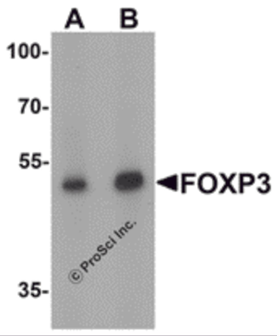 Western blot analysis of FOXP3 in A549 cell lysate with FOXP3 antibody at (A) 1 and (B) 2 μg/mL.