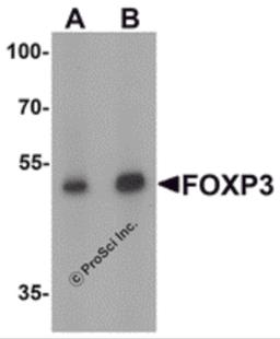 Western blot analysis of FOXP3 in A549 cell lysate with FOXP3 antibody at (A) 1 and (B) 2 μg/mL.