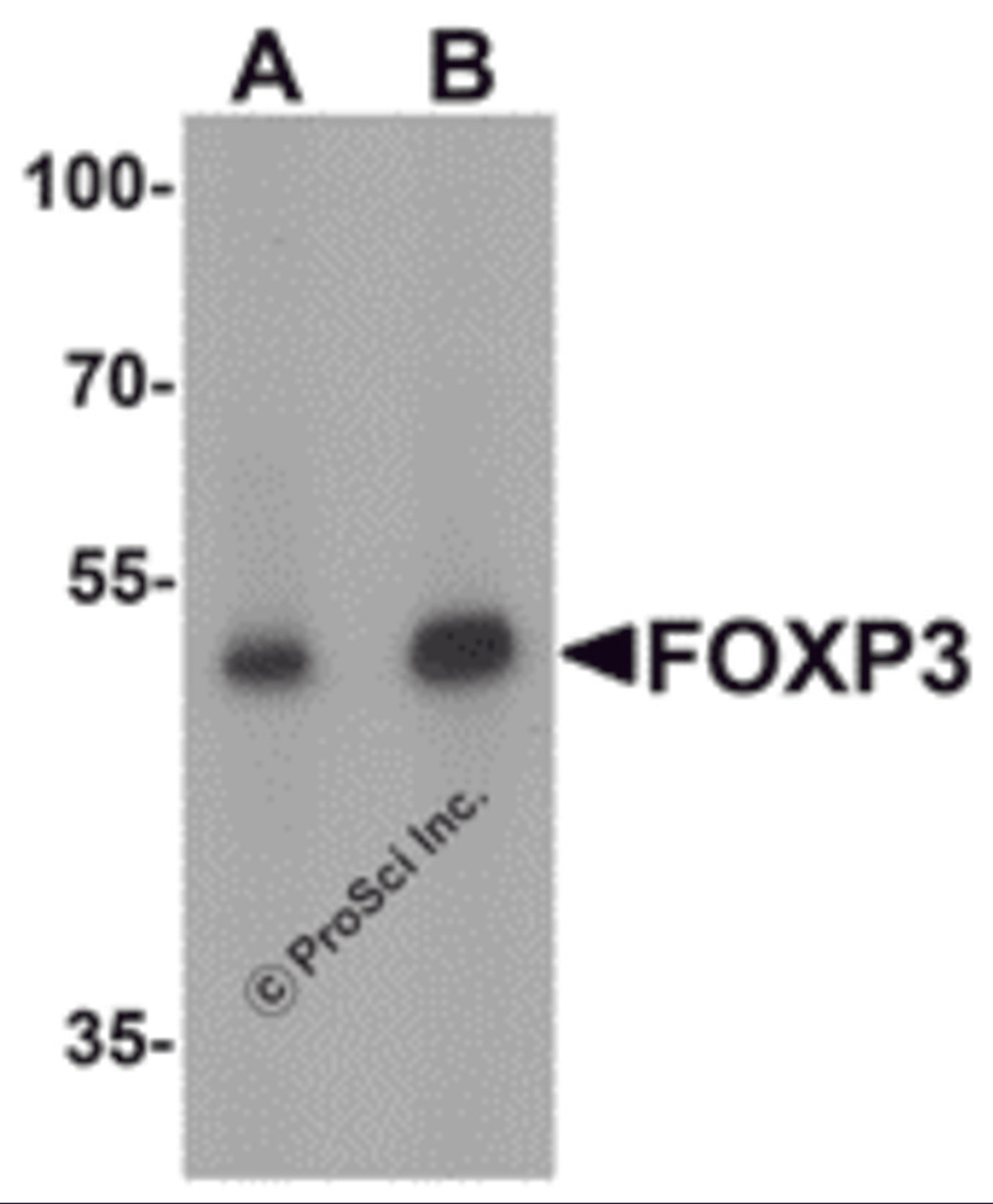 Western blot analysis of FOXP3 in A549 cell lysate with FOXP3 antibody at (A) 1 and (B) 2 μg/mL.