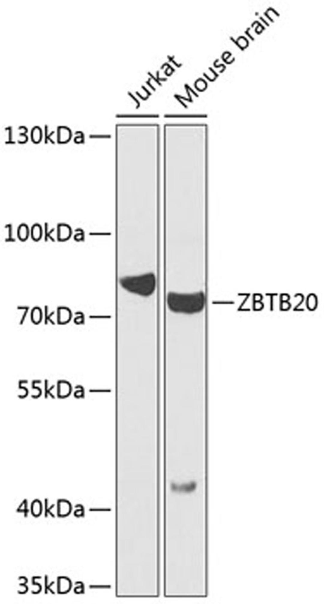 Western blot - ZBTB20 antibody (A7970)