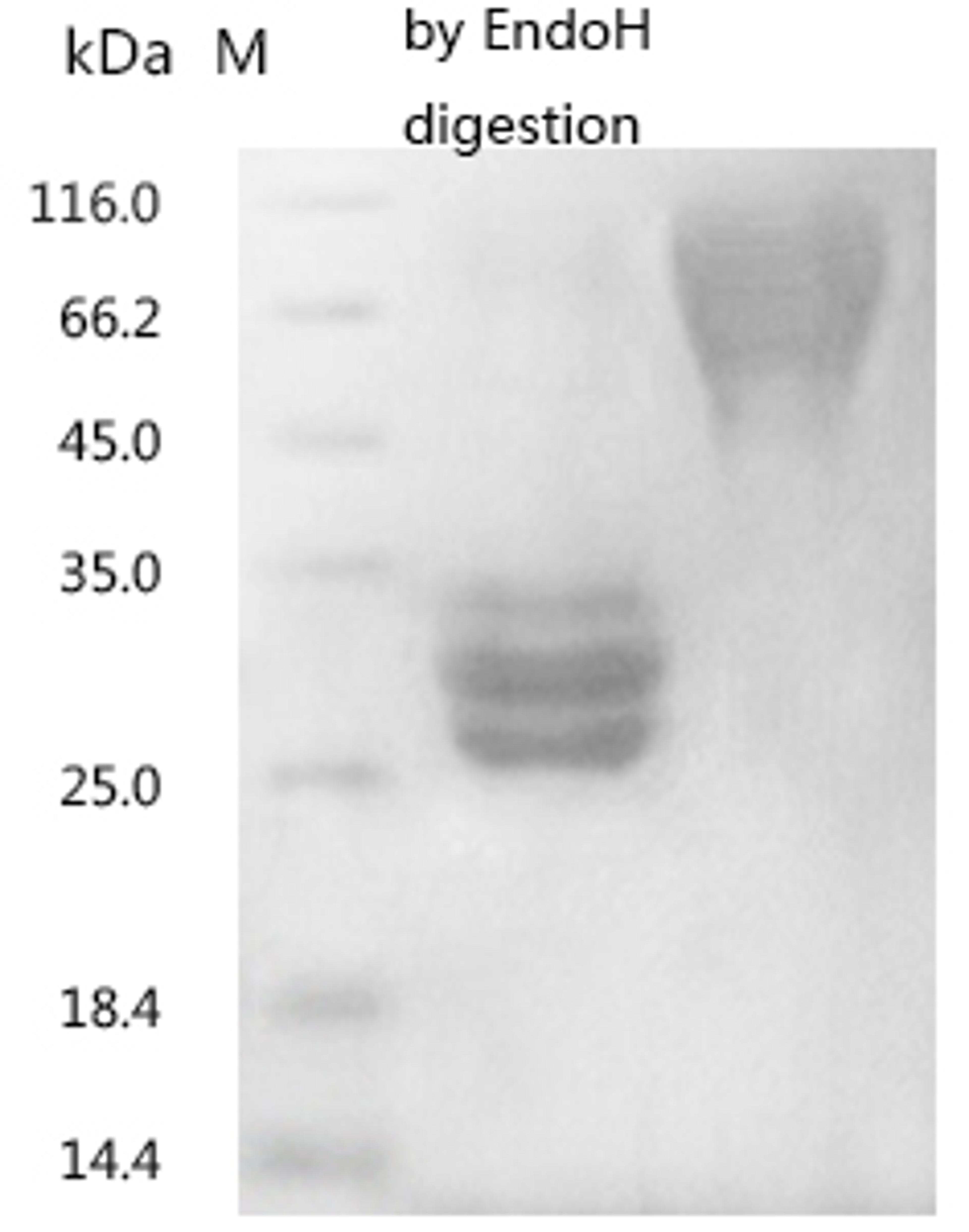 (Tris-Glycine gel) Discontinuous SDS-PAGE (reduced) with 5% enrichment gel and 15% separation gel.