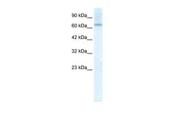 Antibody used in WB on Human HepG2 at 2.5 ug/ml.