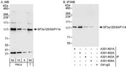 Detection of human SF3a120/SAP114 by western blot and immunoprecipitation.