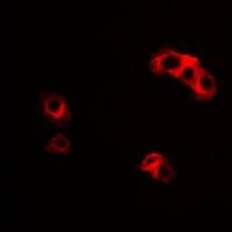 Immunofluorescent analysis of HepG2 cells using IL23R antibody