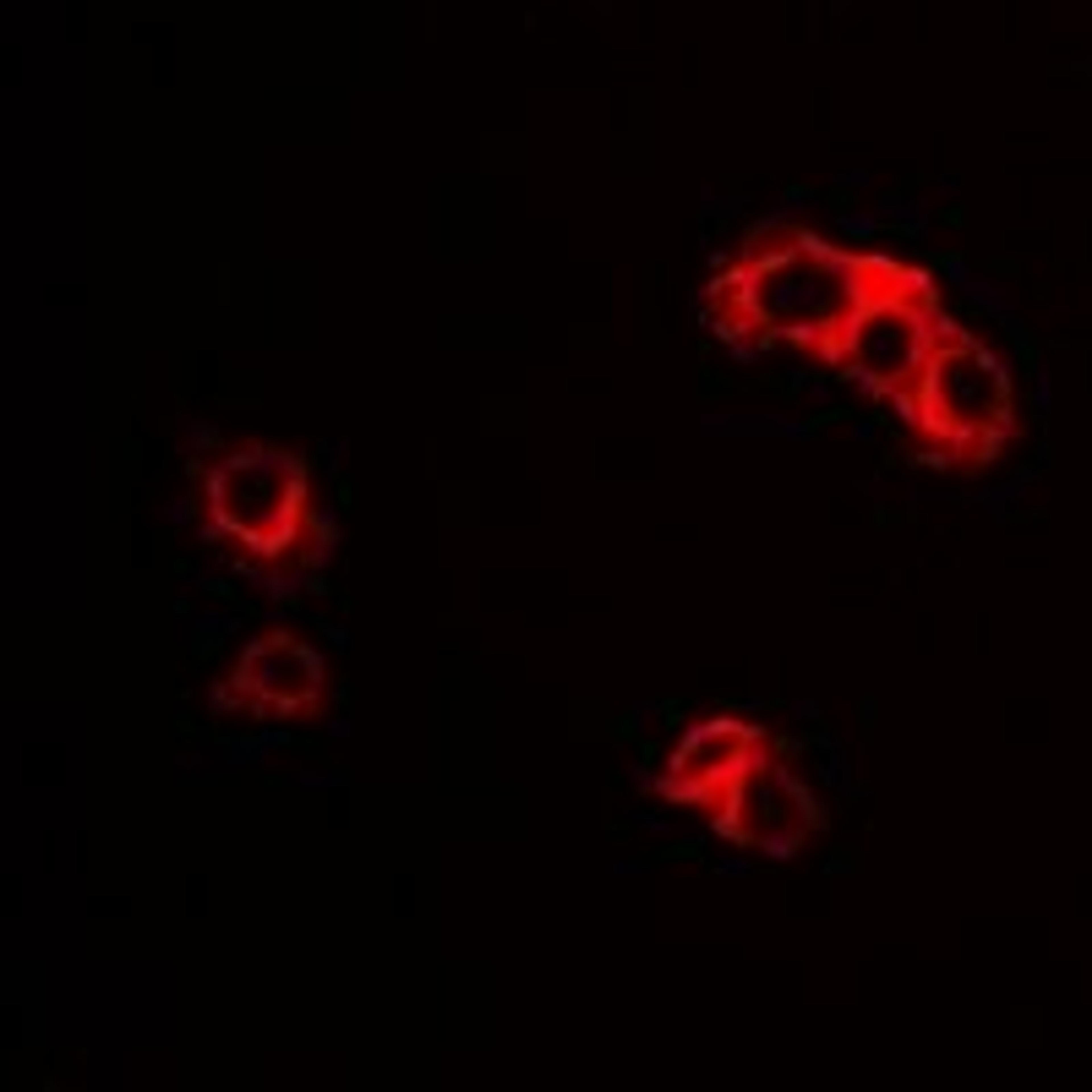 Immunofluorescent analysis of HepG2 cells using IL23R antibody