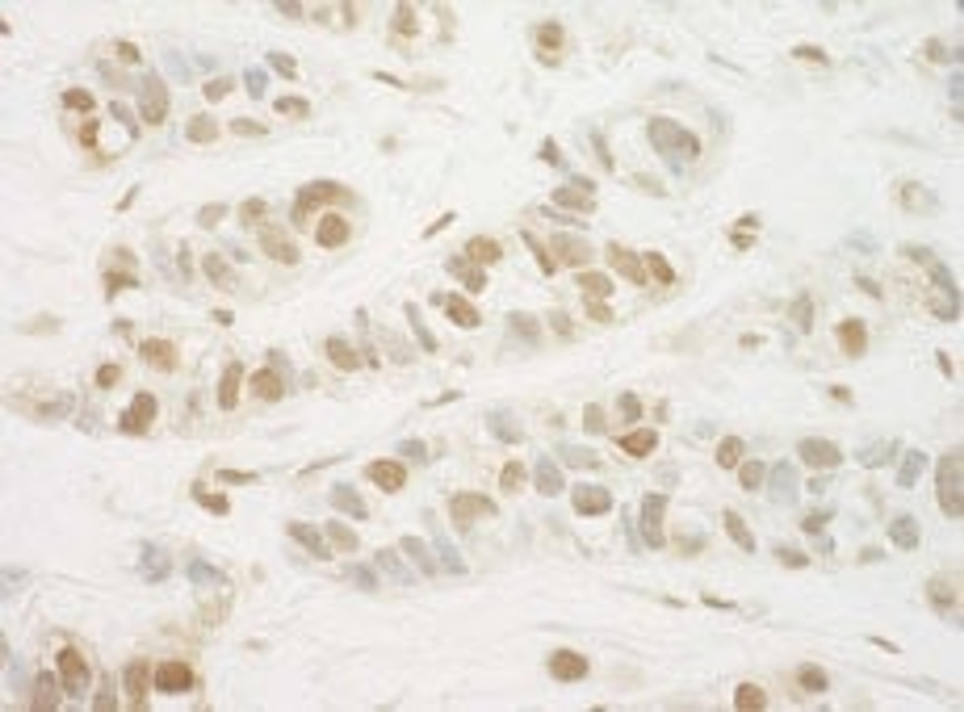 Detection of human MED13L by immunohistochemistry.