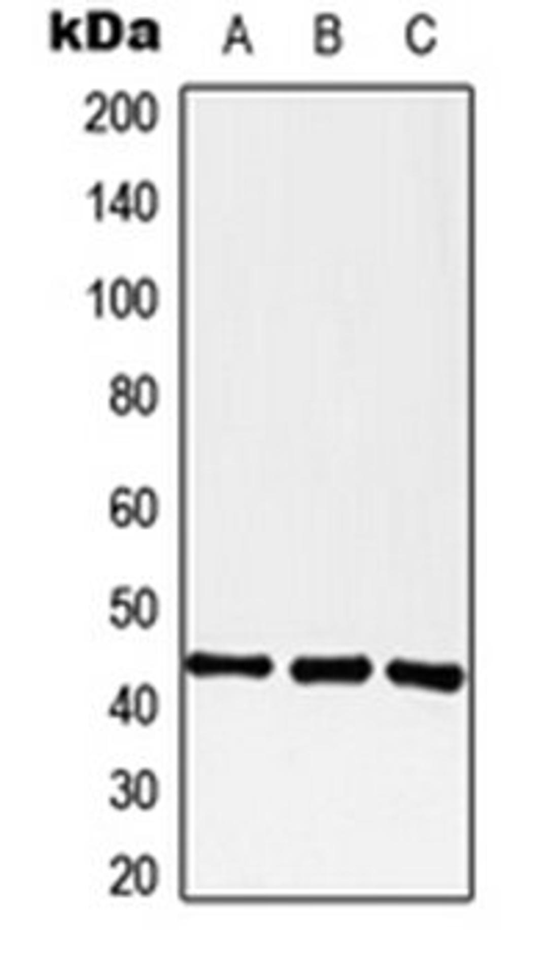 Western blot analysis of A549 (Lane 1), Raw264.7 (Lane 2), PC12 (Lane 3) whole cell lysates using GPR182 antibody