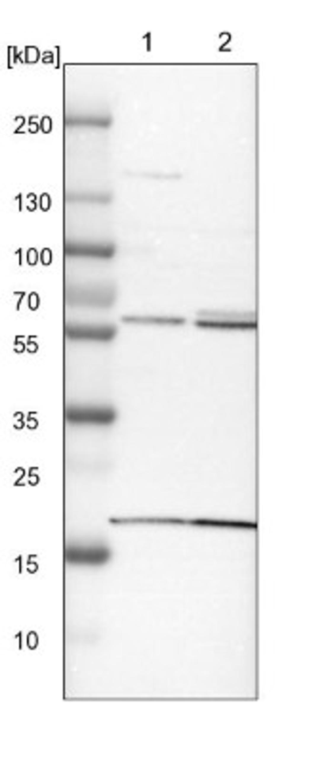 Western Blot: BAIAP2L1 Antibody [NBP1-89537] - Lane 1: NIH-3T3 cell lysate (Mouse embryonic fibroblast cells)<br/>Lane 2: NBT-II cell lysate (Rat Wistar bladder tumour cells)