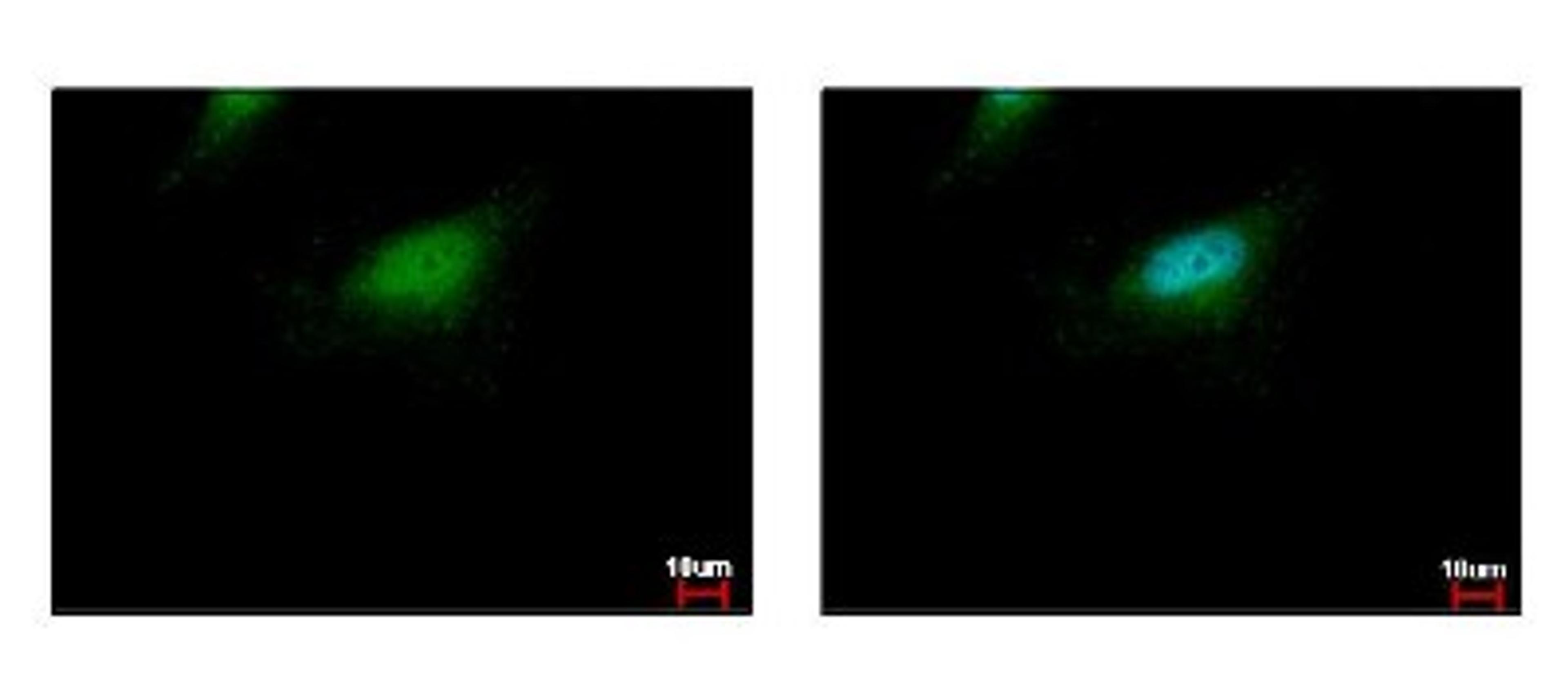 Immunocytochemistry/Immunofluorescence: BLZF1 Antibody [NBP2-15596] - BLZF1 antibody detects BLZF1 protein at cytoplasm and nucleus by immunofluorescent analysis. Sample: HeLa cells were fixed in 4% paraformaldehyde at RT for 15 min. Green: BLZF1 protein stained by BLZF1 antibody diluted at 1:500. Blue: Hoechst 33343 staining.