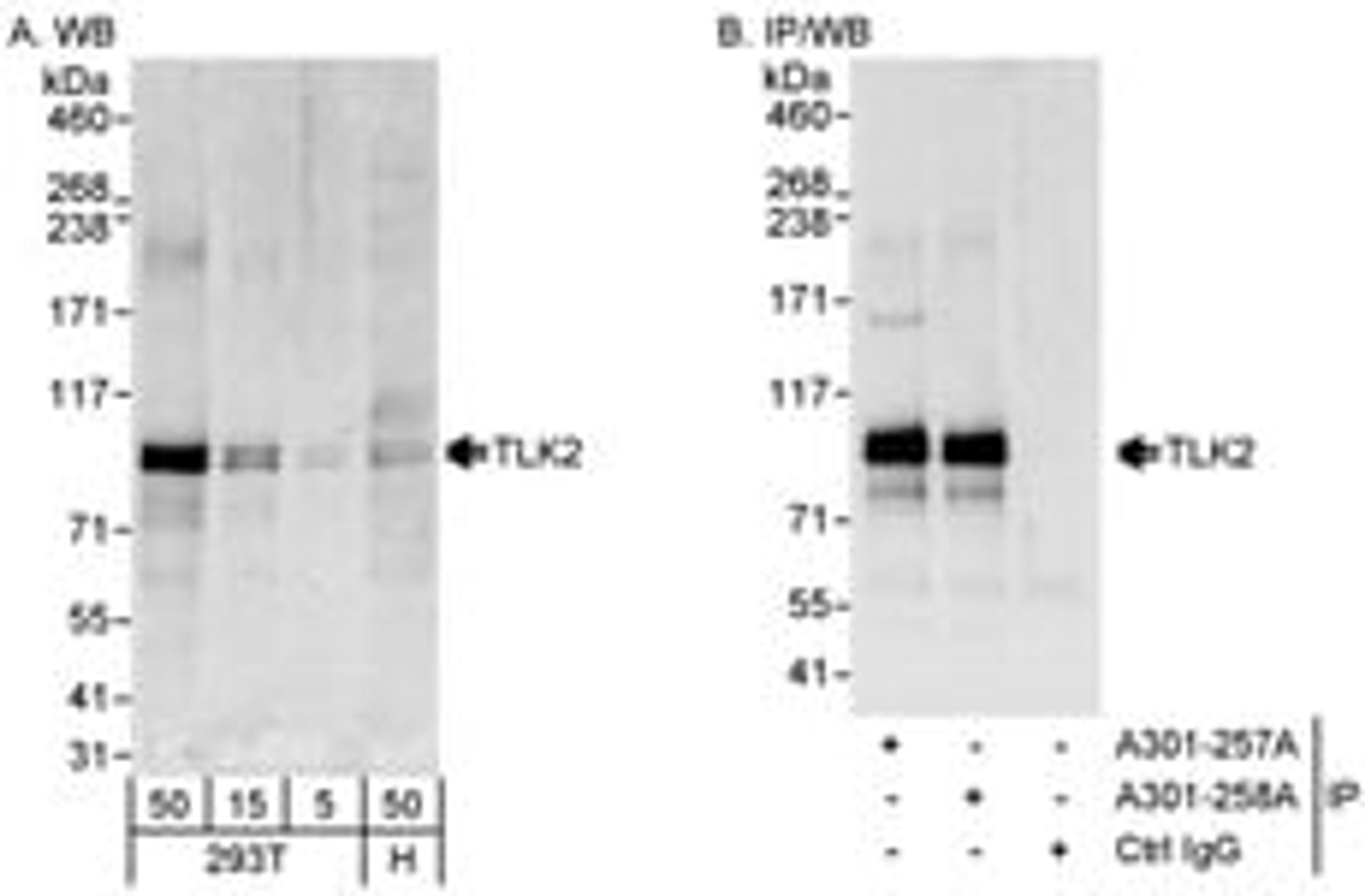 Detection of human TLK2 by western blot and immunoprecipitation.