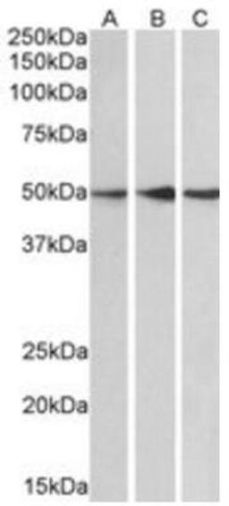 Western Blot: PPP2R5E Antibody [NB100-845] - Staining (0.1ug/ml) of Human Cerebellum (A), Mouse (B) and Rat (C) Brain lysate (35ug protein in RIPA buffer). Primary incubation was 1 hour. Detected by chemiluminescence.