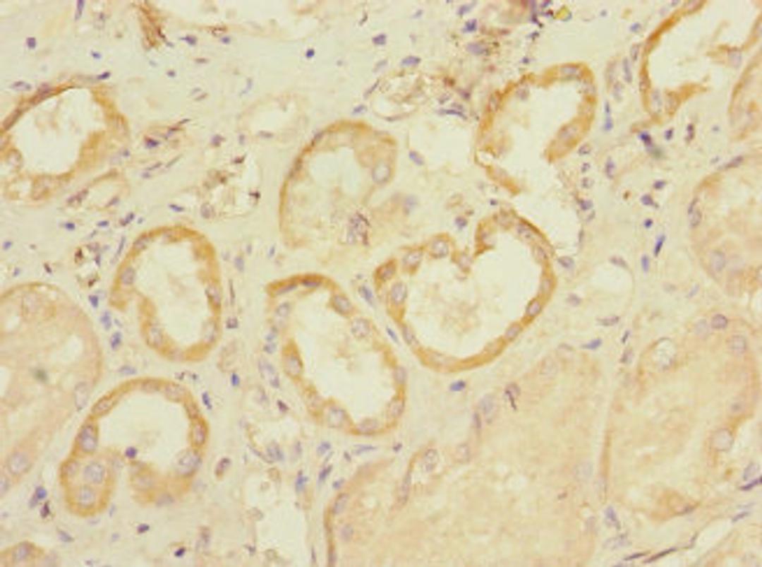 Immunohistochemistry of paraffin-embedded human kidney tissue using CSB-PA021539LA01HU at dilution of 1:100