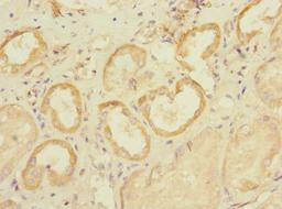 Immunohistochemistry of paraffin-embedded human kidney tissue using CSB-PA021539LA01HU at dilution of 1:100