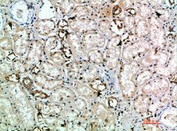 Immunohistochemical analysis of paraffin-embedded human-kidney, antibody was diluted at 1:200