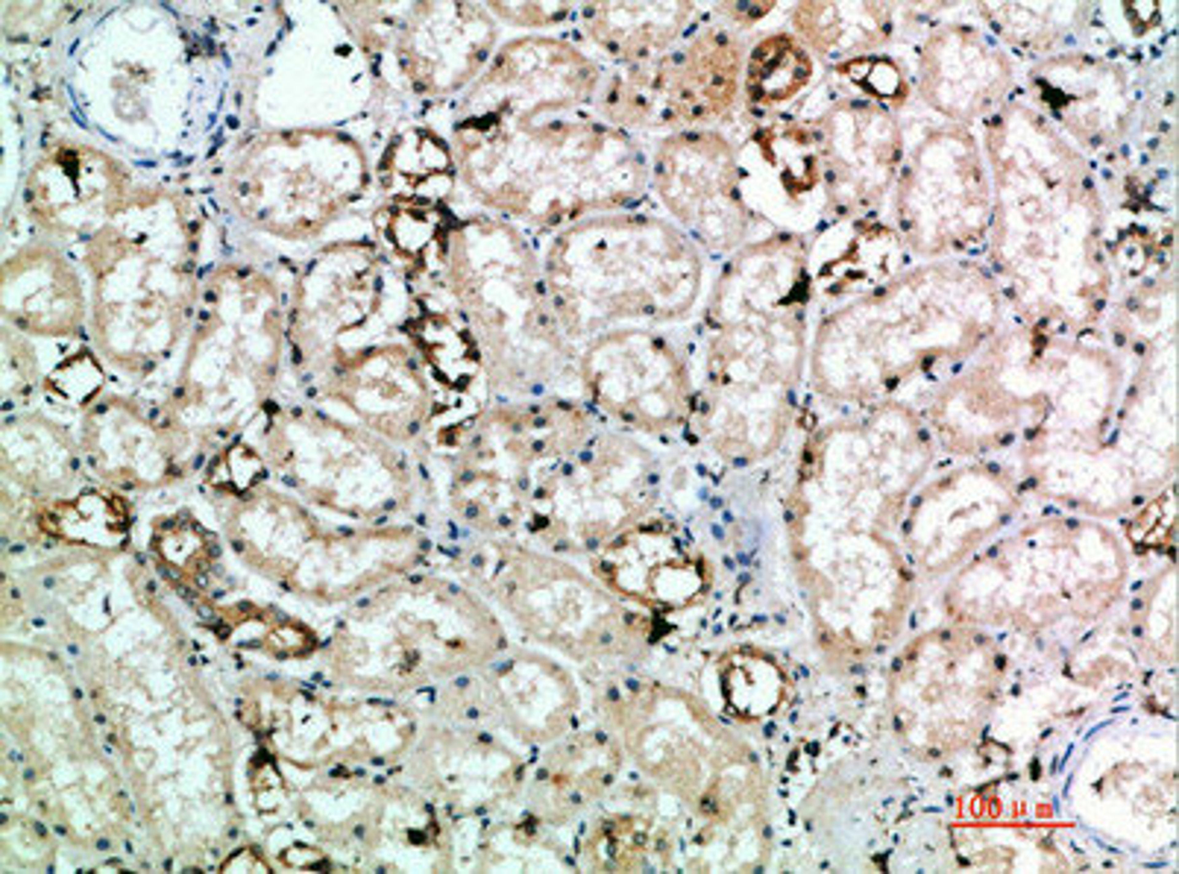 Immunohistochemical analysis of paraffin-embedded human-kidney, antibody was diluted at 1:200